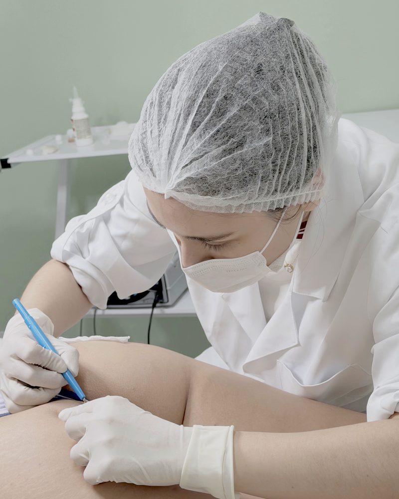 Dra. Roberta Sayuri, de touca e máscara, marca com caneta cirúrgica a área de um pequeno procedimento na pele
